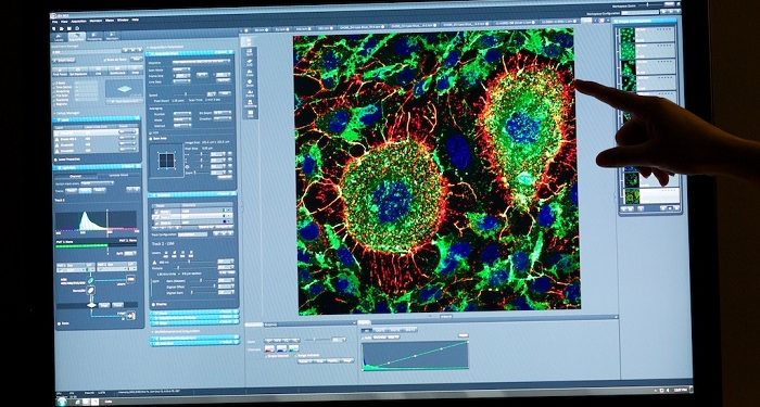 A l’assaut du cerveau, la biotech marseillaise Vect-Horus veut lever encore plusieurs millions