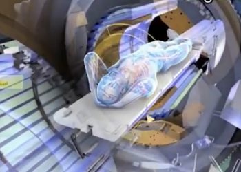 L’institut Paoli Calmettes s’équipe du dernier cri de la radiothérapie