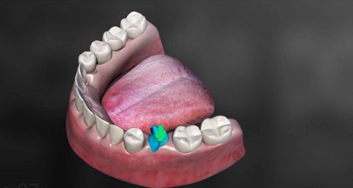 Biotech Dental lève 52 millions d'euros auprès de Sofina