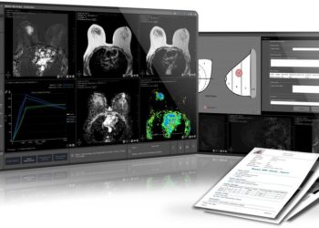 Intrasense (45 salariés à Montpellier), labellisée « entreprise innovante » par la BPI, annonce la mise en place d’un financement par Emission d’obligations convertibles en actions (OCA) pour un montant de 3,5 M€ sur 3 ans