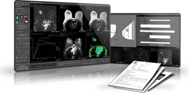 Intrasense (45 salariés à Montpellier), labellisée « entreprise innovante » par la BPI, annonce la mise en place d’un financement par Emission d’obligations convertibles en actions (OCA) pour un montant de 3,5 M€ sur 3 ans