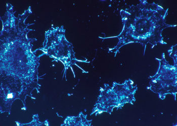 L’équipe d’hématologie du CHU de Montpellier utilise des cellules reprogrammées pour traiter certains patients atteints d’un lymphome particulier ou d’une leucémie aiguë lymphoblastique. Photo : Pixabay (libre de droits)