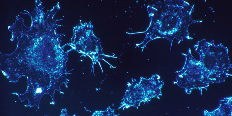 L’équipe d’hématologie du CHU de Montpellier utilise des cellules reprogrammées pour traiter certains patients atteints d’un lymphome particulier ou d’une leucémie aiguë lymphoblastique. Photo : Pixabay (libre de droits)