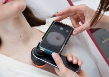 Anapix propose aux médecins et aux patients de repérer très tôt les potentiels mélanomes