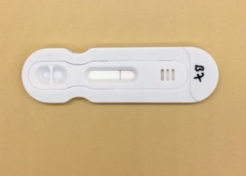 Xrapid et Medisur lancent un test sérologique rapide du Covid pour les entreprises