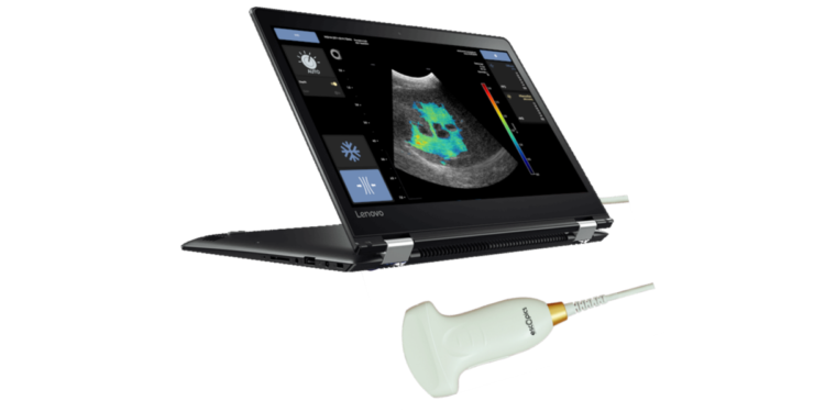 Léchographe dE-scopics est composé dune sonde et dune application logicielle DR)