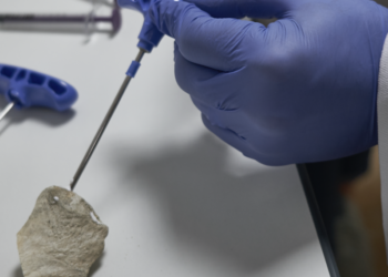 Graftys et Biologics for Life ont développé toutes les deux des solutions injectables pour réparer les os (Crédit DR)