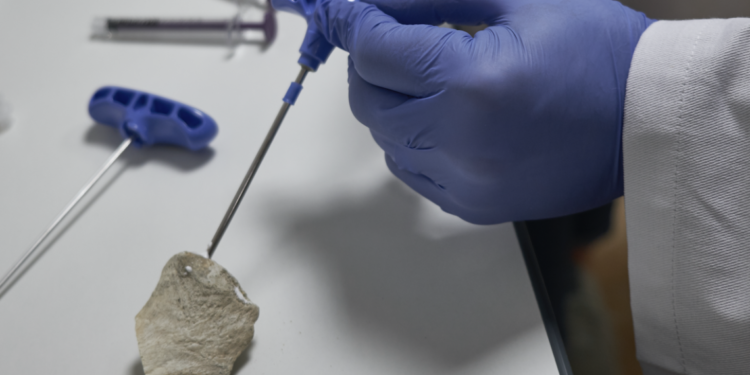 Graftys et Biologics for Life ont développé toutes les deux des solutions injectables pour réparer les os (Crédit DR)