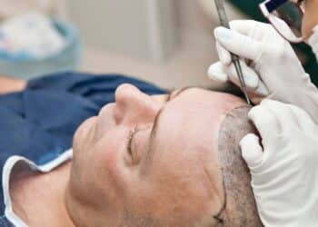 Greffe de cheveux : Pourquoi les célébrités se tournent vers la Turquie ?